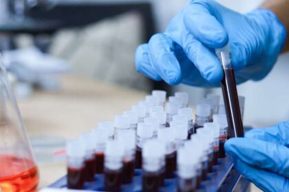 Objevování nového typu krve: Gwada-negativní