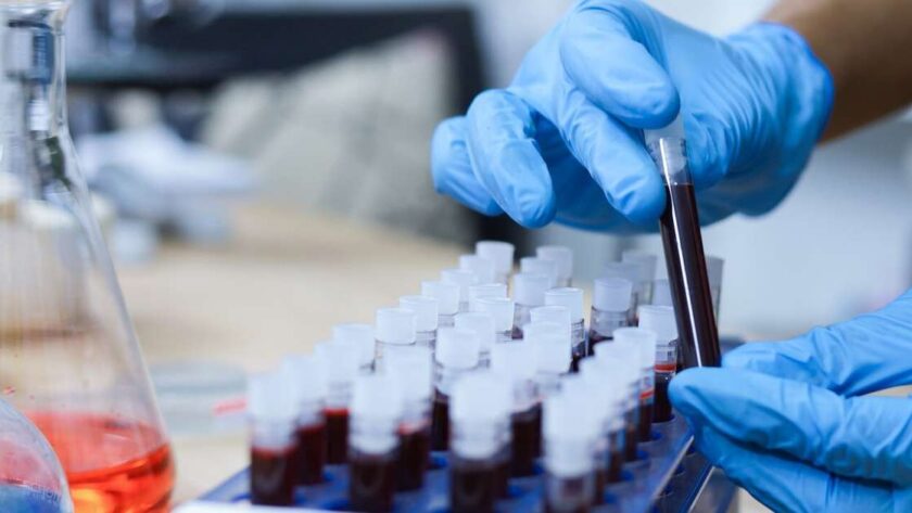 Objevování nového typu krve: Gwada-negativní