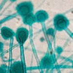 Vliv klimatických změn na kvasinkové infekce u žen