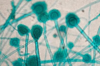 Vliv klimatických změn na kvasinkové infekce u žen