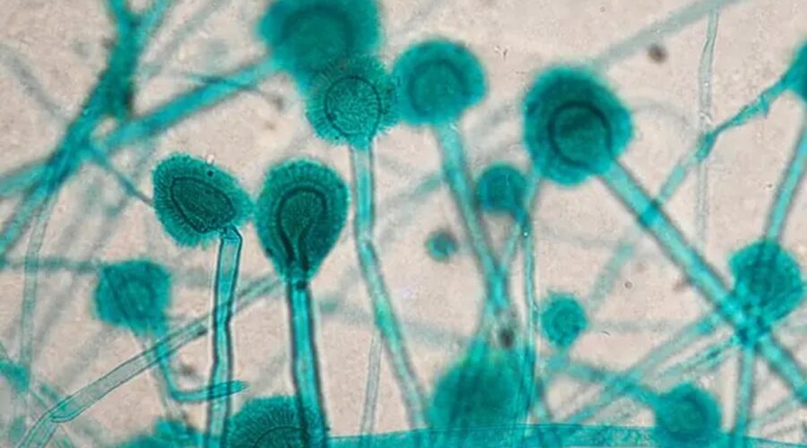 Vliv klimatických změn na kvasinkové infekce u žen